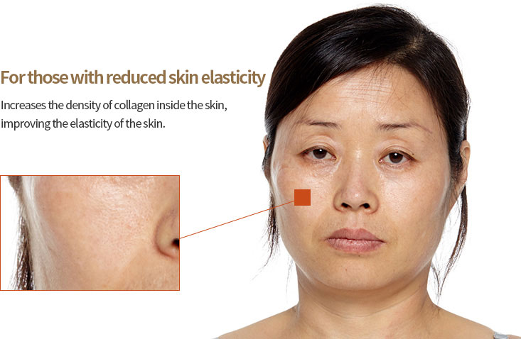 Reduction of Skin Elasticity