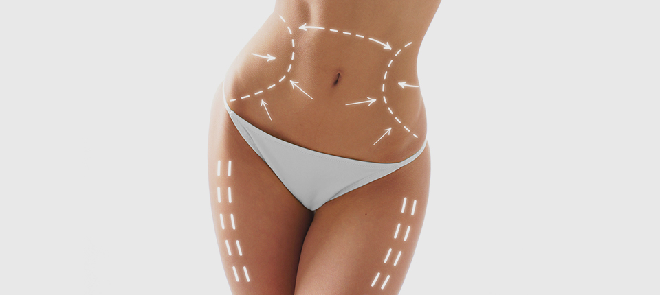 Safely removes only fat collected fat Minimizes scarring and bleeding