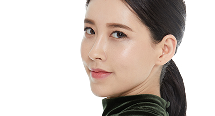 Non-incisional Double Eyelid Surgery