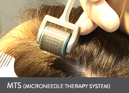 mts(microneedle theraphy system)