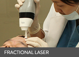 fractional laser